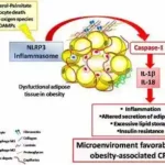 Inflamation